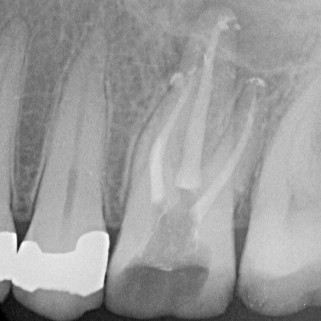 Endodontie